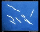 borrelia darkfield microscopy